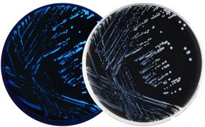 Buffered Charcoal Yeast Extract (BCYE) Agar - #1 Microbiology Resource Hub