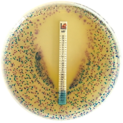 <strong>Chromogenic culture media for detecting antimicrobial resistance mechanisms</strong>