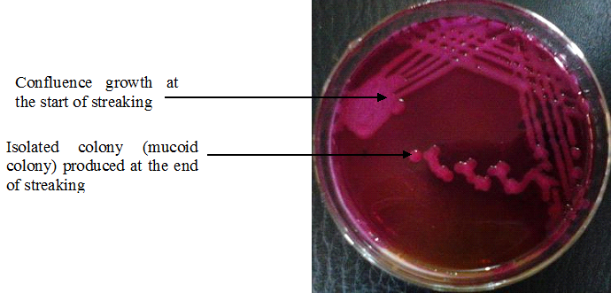 <strong>Colonial morphology of microorganisms</strong>