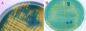 URINE CULTURE TECHNIQUE – Microbiology Class