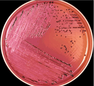 STOOL CULTURE TECHNIQUE - Microbiology Class