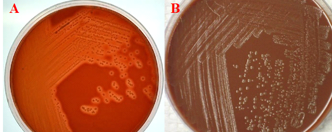 Csf Sample