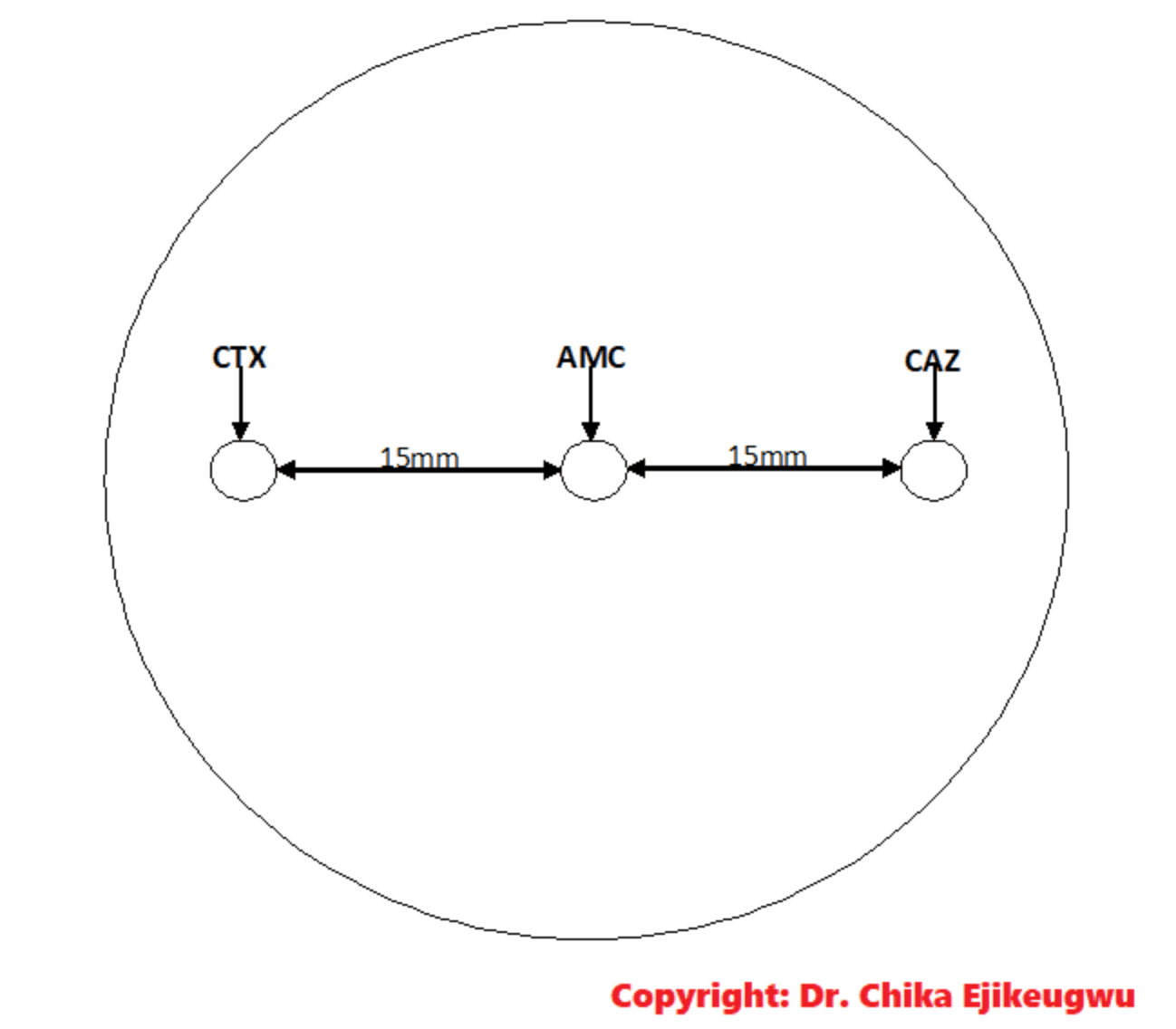 Phenotypic Detection of Extended Spectrum Beta-Lactamase (ESBL) Bacteria