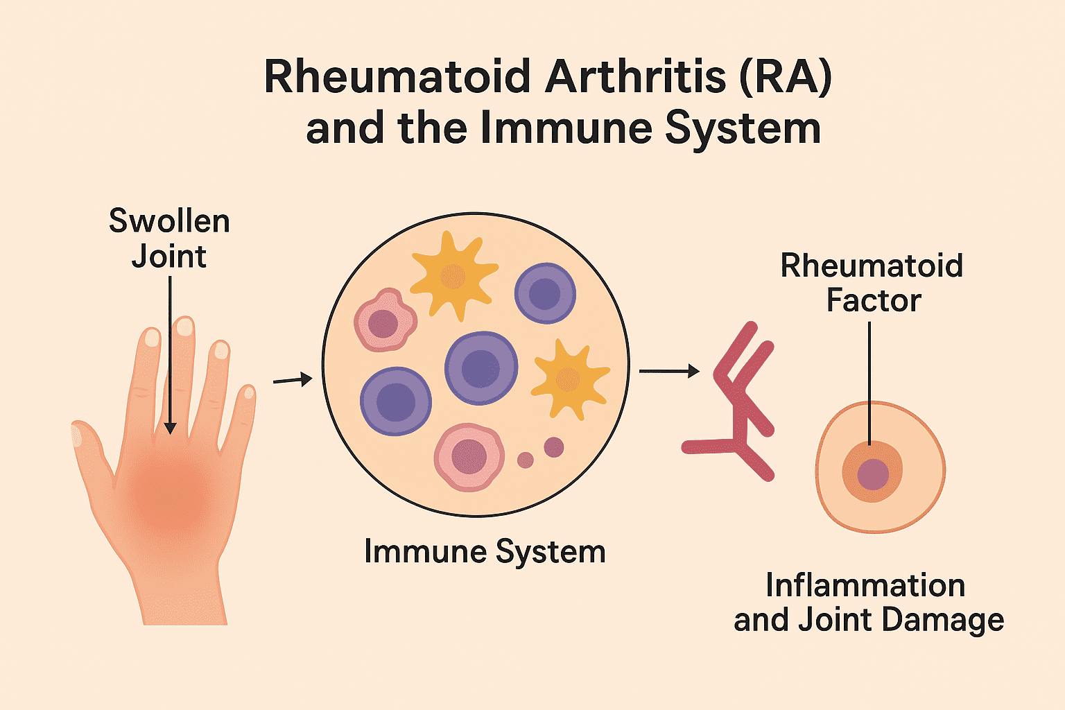 From Genes to Joints: Understanding Rheumatoid Arthritis as an Autoimmune Disease