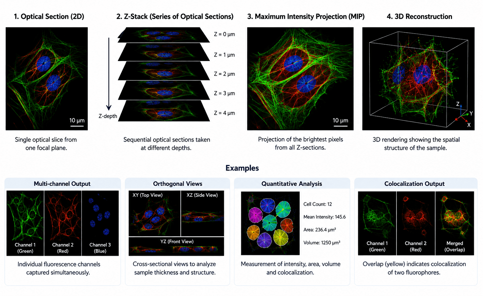 Confocal Microscopy: Understanding Principles, Instrumentation, and ...